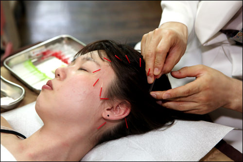 椿漢方クリニック で美容鍼にチャレンジ 韓国美容医療体験レポート 韓国旅行 コネスト